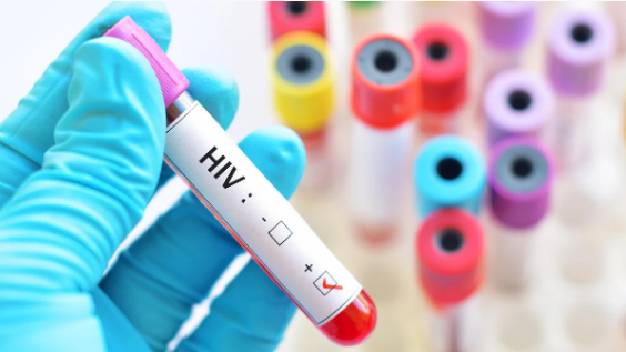 HIV ENFEKSİYONLARINI NEREDEN YÜZDE 100 ÖNLEYEBİLEN BİR İLAÇ BULUNDU