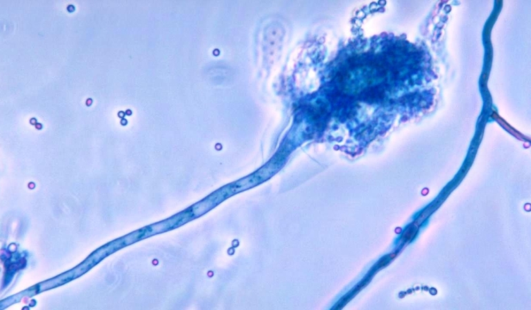 KÜRESEL ISINMA YENİ SAĞLIK TEHDİDİNİ TETİKLİYOR